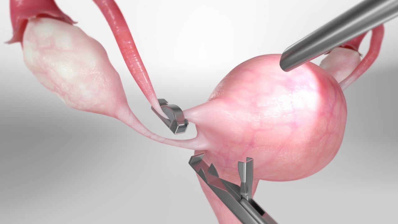 tuballigationclips_1280